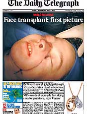 Jornal "Daily Telegraph" estampa rosto no ps-operatrio