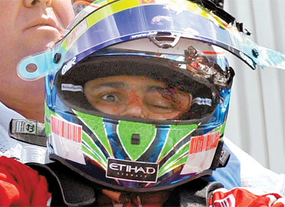 Consciente, Massa  retirado de sua Ferrari aps ser golpeado na cabea em treino na Hungria