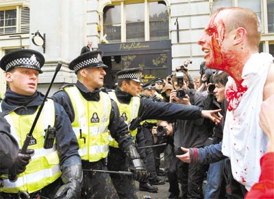 Manifestante ensanguentado aps conflito com a polcia durante<br>a reunio do G20, em Londres; protesto reuniu cerca de 5.000