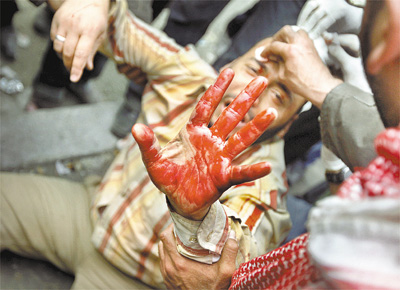 Manifestante ferido em conflito durante protesto prximo ao Museu Egpcio (Cairo), em mais um dia de enfrentamento